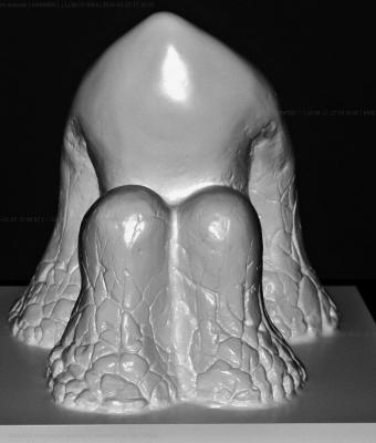 lobotomia