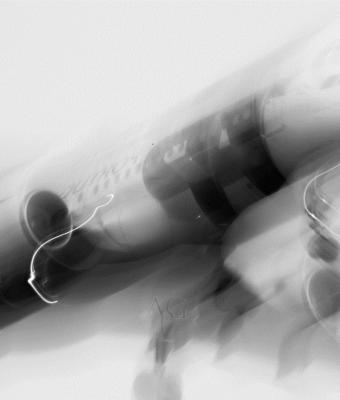 aereo