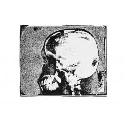 rx-cranio-laterolaterale