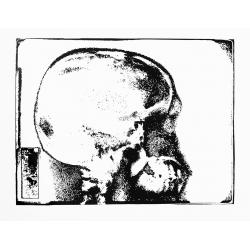 rx-cranio-laterolaterale-12