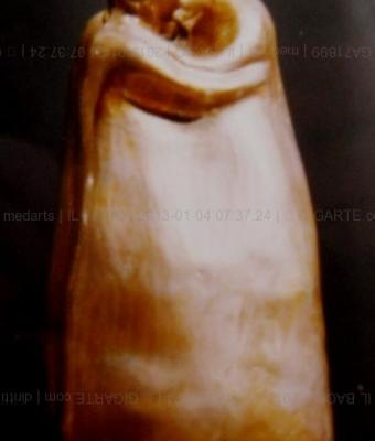 il-bacio