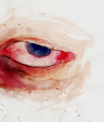 dark-circles